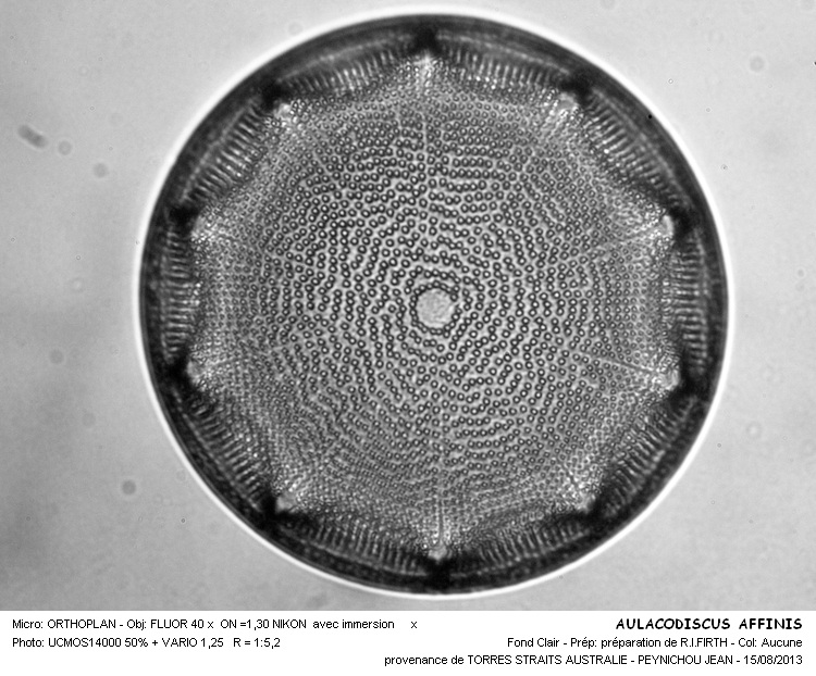 AULACODISCUS AFFINIS #33336
