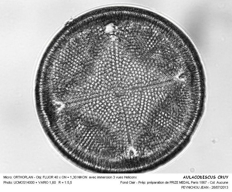 AULACODISCUS CRUX #32925