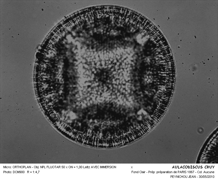 AULACODISCUS CRUX #32348