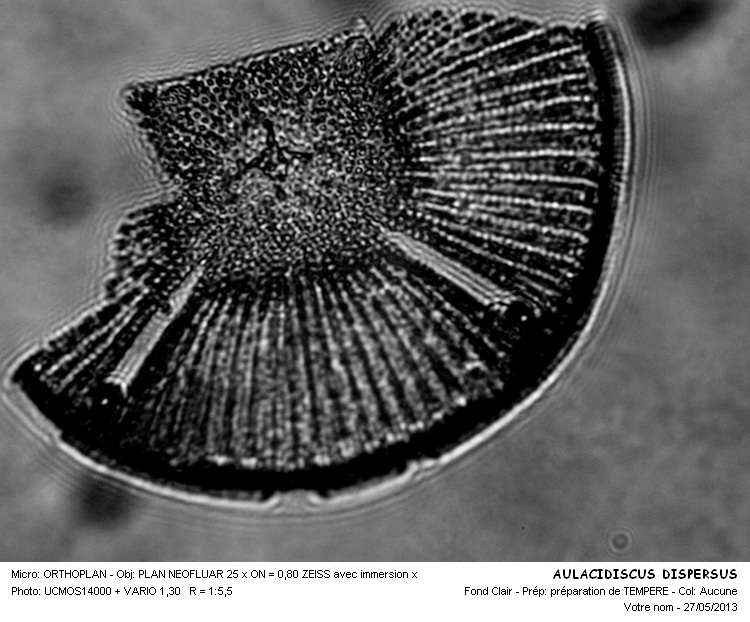 AULACODISCUS DISPERSUS #31405