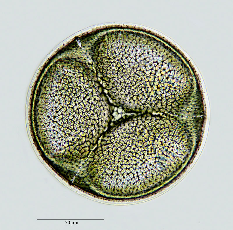 Aulacodiscus excavatus A. Schmidt #29929