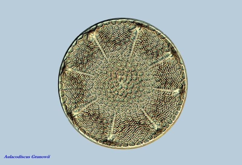 Aulacodiscus Grunowii #35667