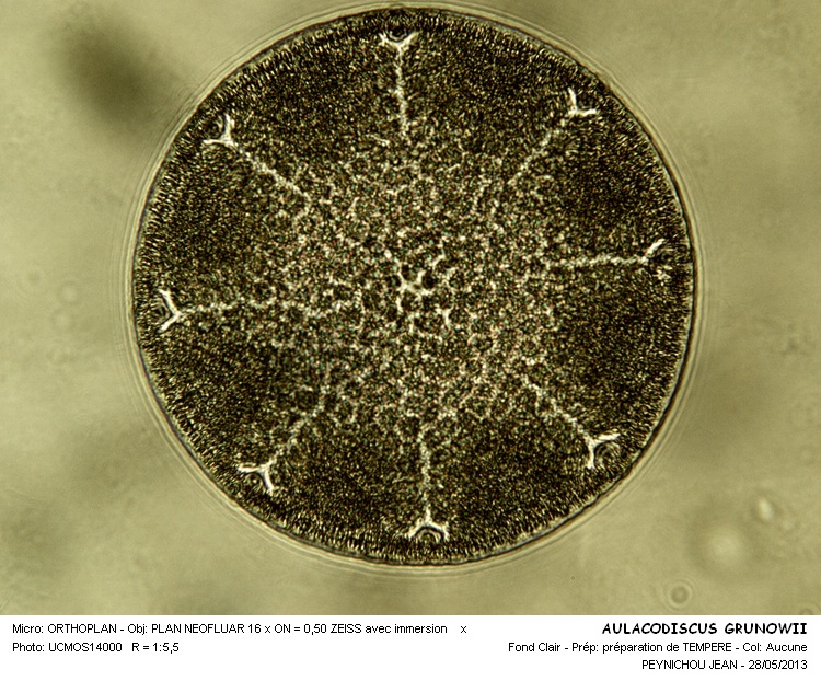 AULACODISCUS GRUNOWII #31440