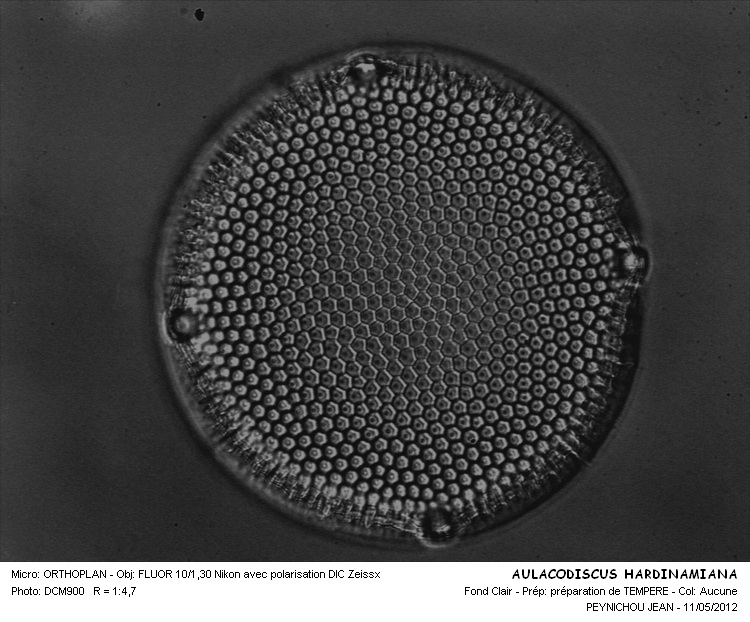 AULACODISCUS HARDMANIANUS #31395