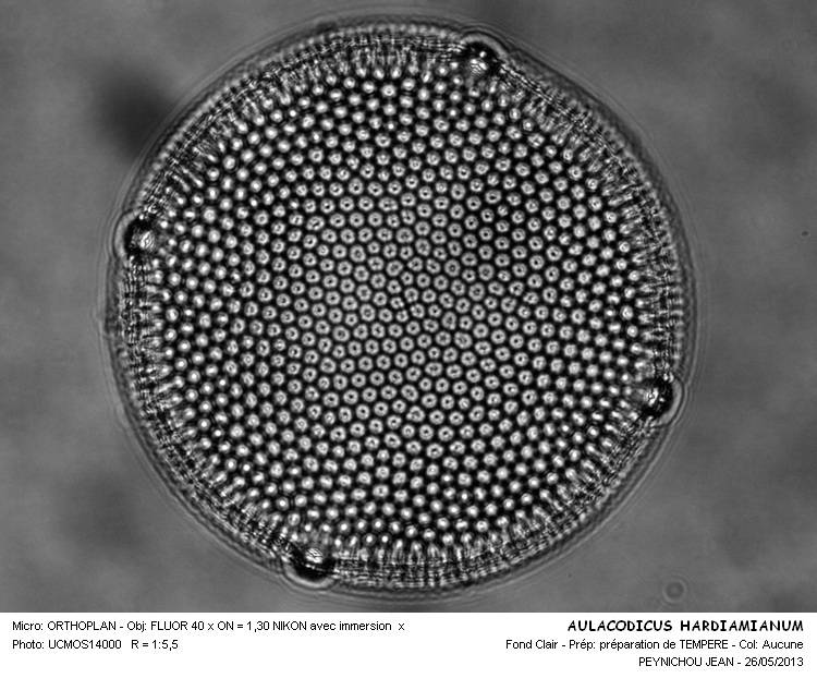 AULACODISCUS HARDMANIANUS #31396