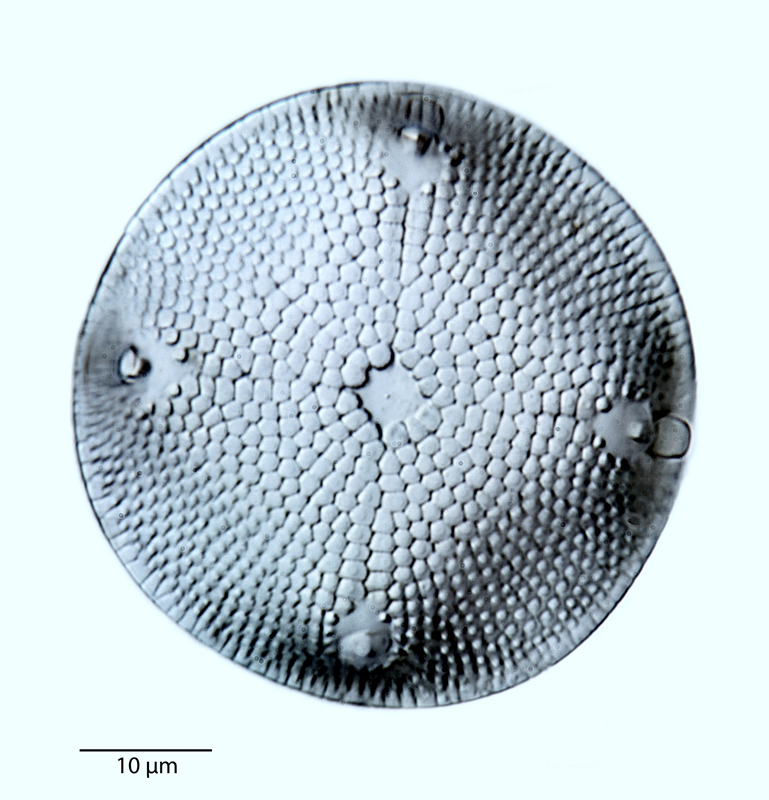 Aulacodiscus kilkellyanus #40822