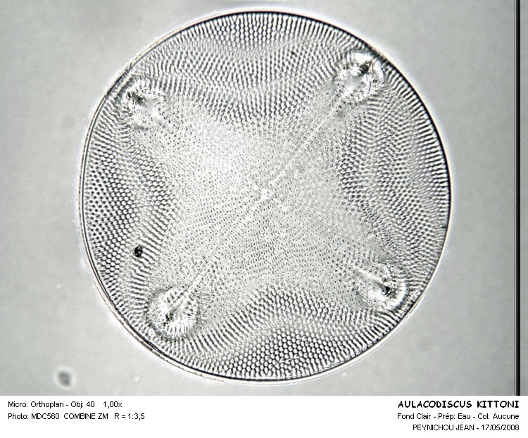 AULACODISCUS KITTONII #32357