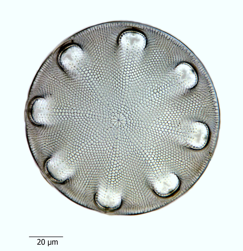 Aulacodiscus kittonii #65918