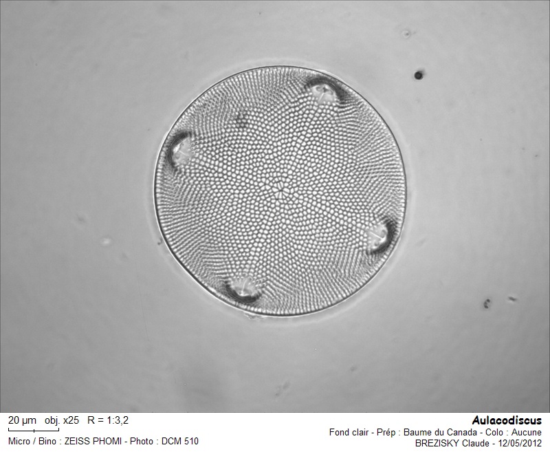 Aulacodiscus kittonii #28715