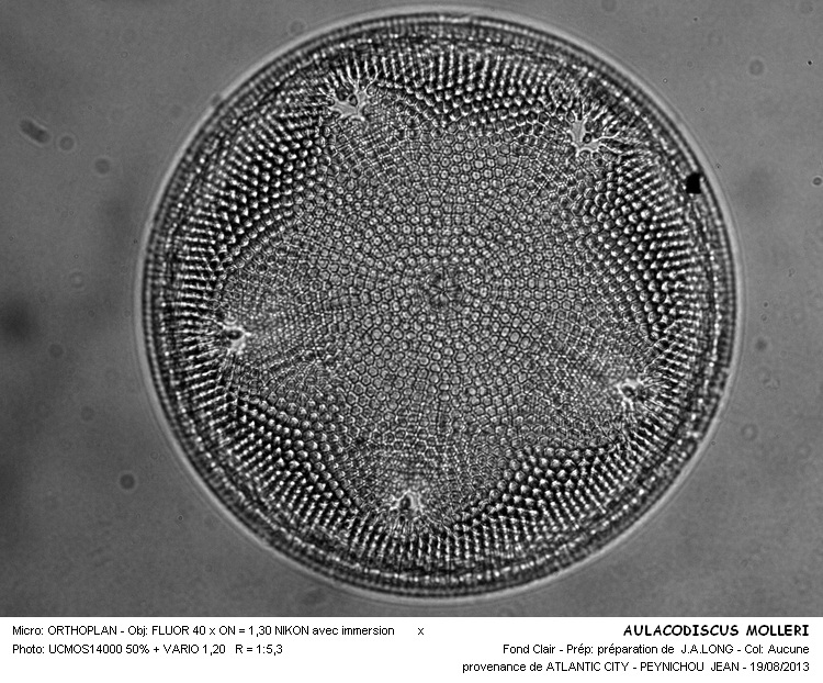 AULACODISCUS MOLLERI #33375