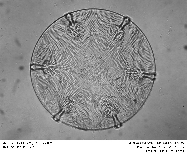 AULACODISCUS NORMANIANUS #13094