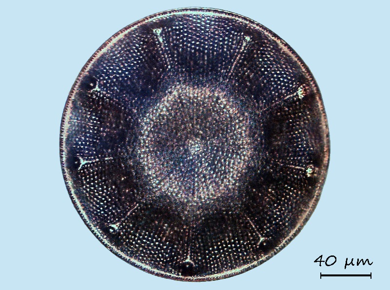 Aulacodiscus patulus #69283