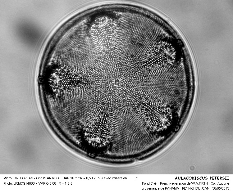 Aulacodiscus petersi Ehrenberg. #31479