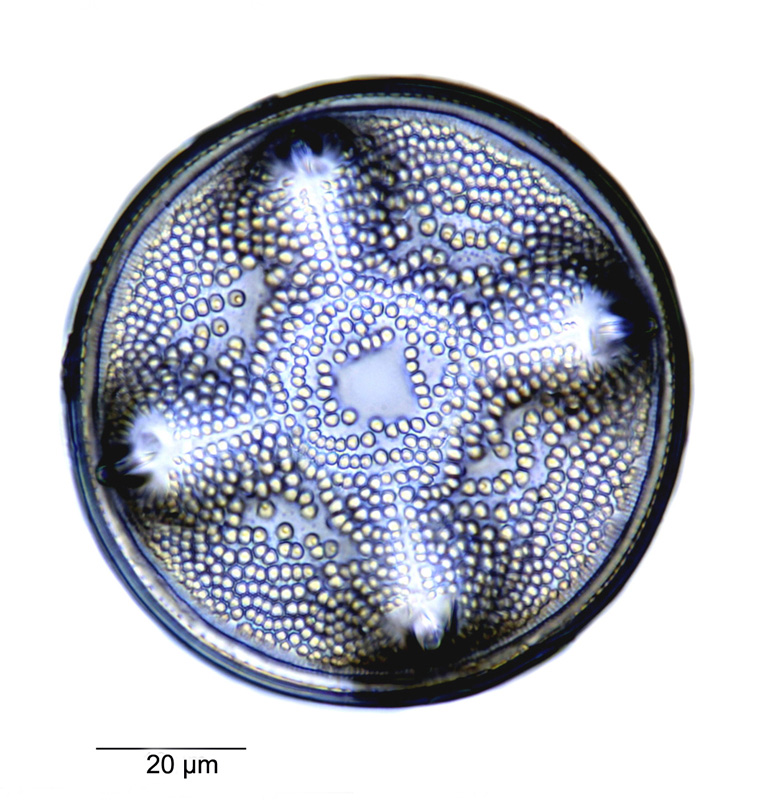 Aulacodiscus pugnalus #79252