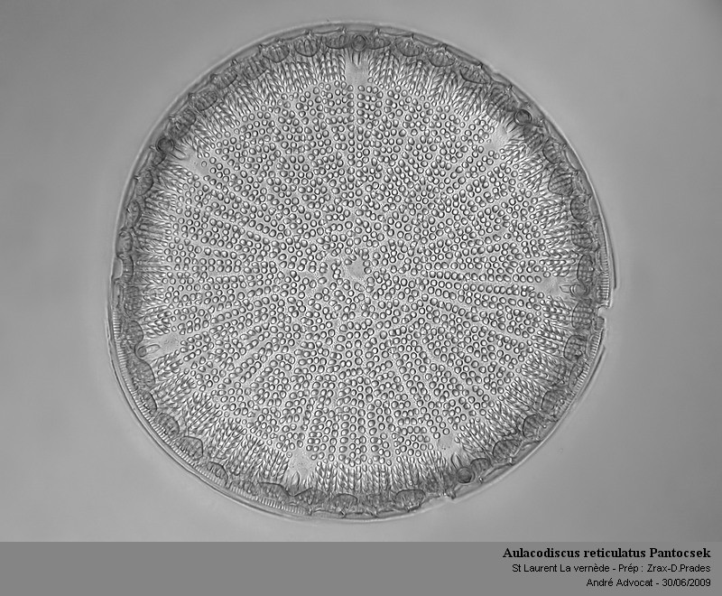Aulacodiscus reticulatus Pantocsek #11620