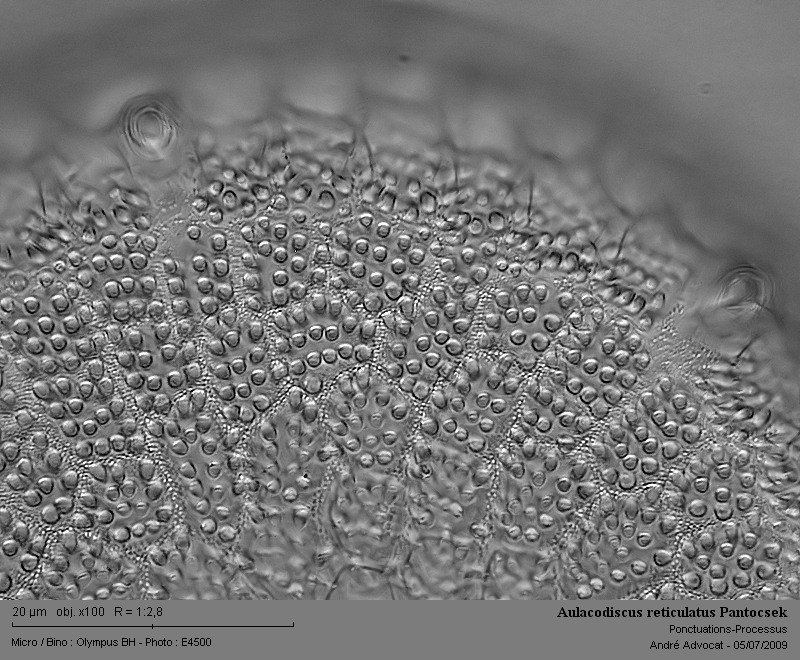 Aulacodiscus reticulatus Pantocsek #11622