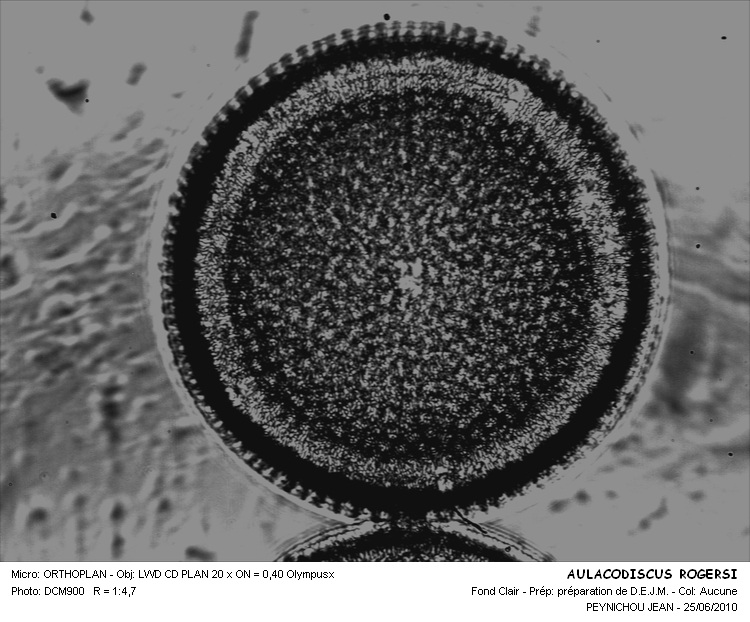 AULACODISCUS ROGERSII #32360