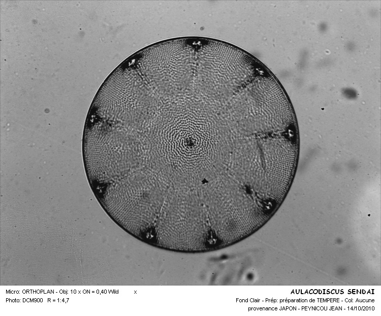 AULACODISCUS SENDAI #32335