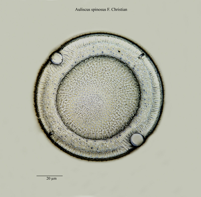 Auliscus spinosus F. Christian #23511