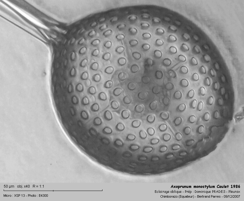 Axoprunum monostylum Caulet 1986 #2401