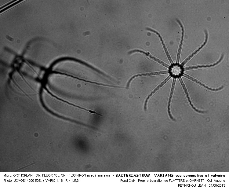BACTERIASTRUM VARIANS vue connective et valvaire #33447