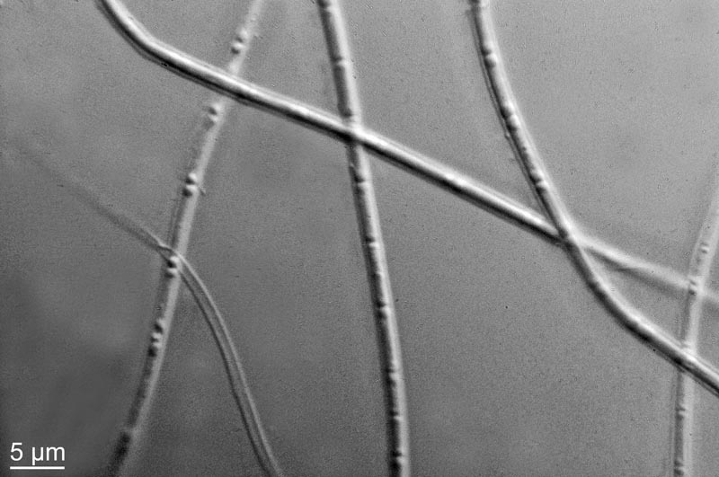 Bactéries et cyanobactéries du plan d eau de Hommes (37) #42237