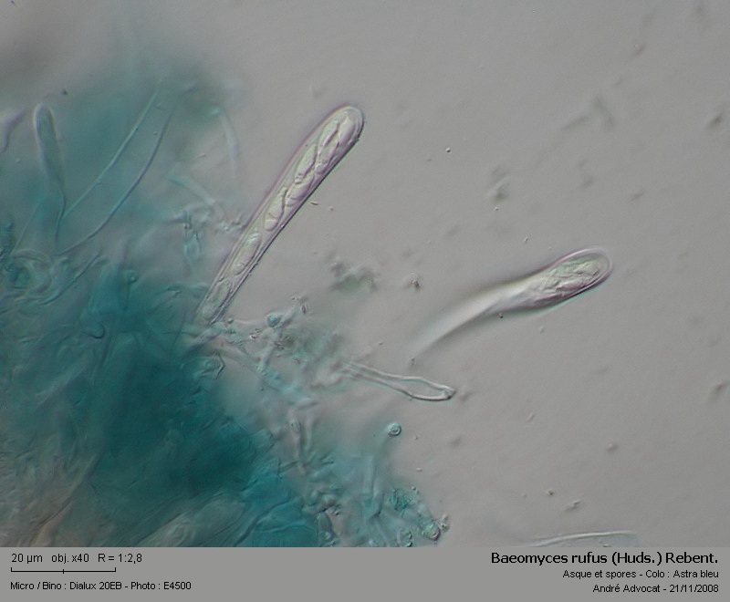 Baeomyces rufus (Huds.) Rebent. #6889