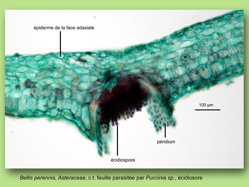 Bellis perennis, Puccinia, Histologie, Histology #25171