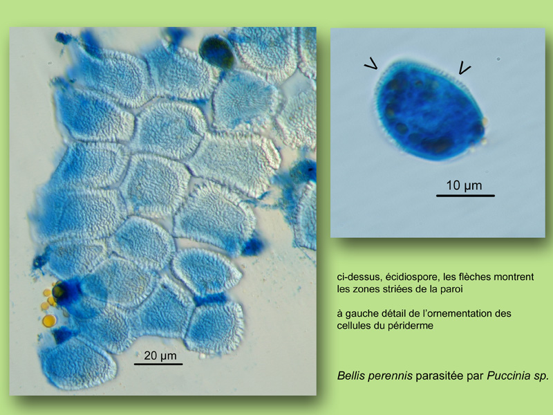 Bellis perennis, Puccinia, Histologie, Histology #25172