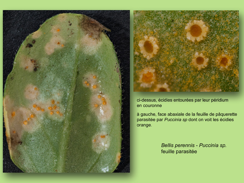 Bellis perennis, Puccinia, Histologie, Histology #25170