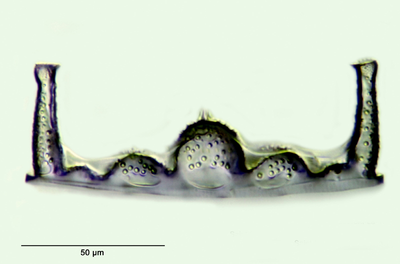 Biddulphia elegantula Greville #32626