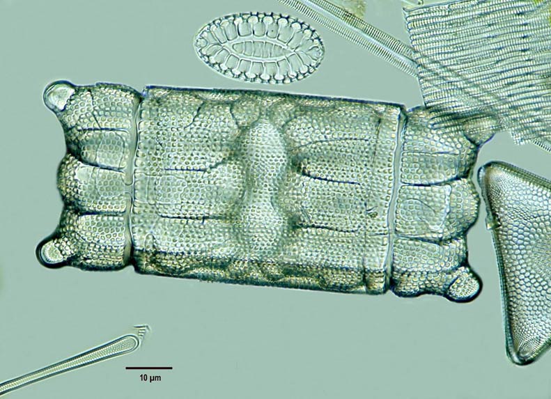 Biddulphia pulchella Gray. #7751