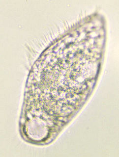 Blepharisma lateritia #36397
