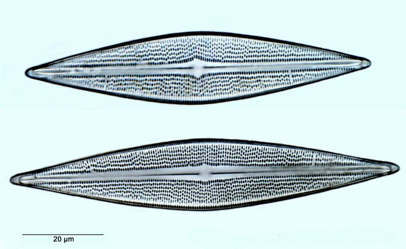 Brachysira serians #37235