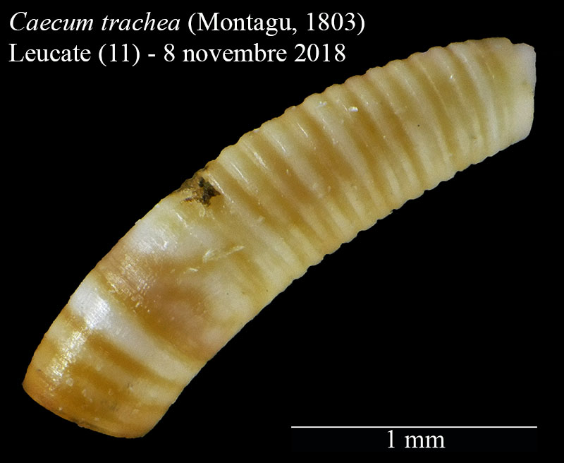 Caecum trachea #59236
