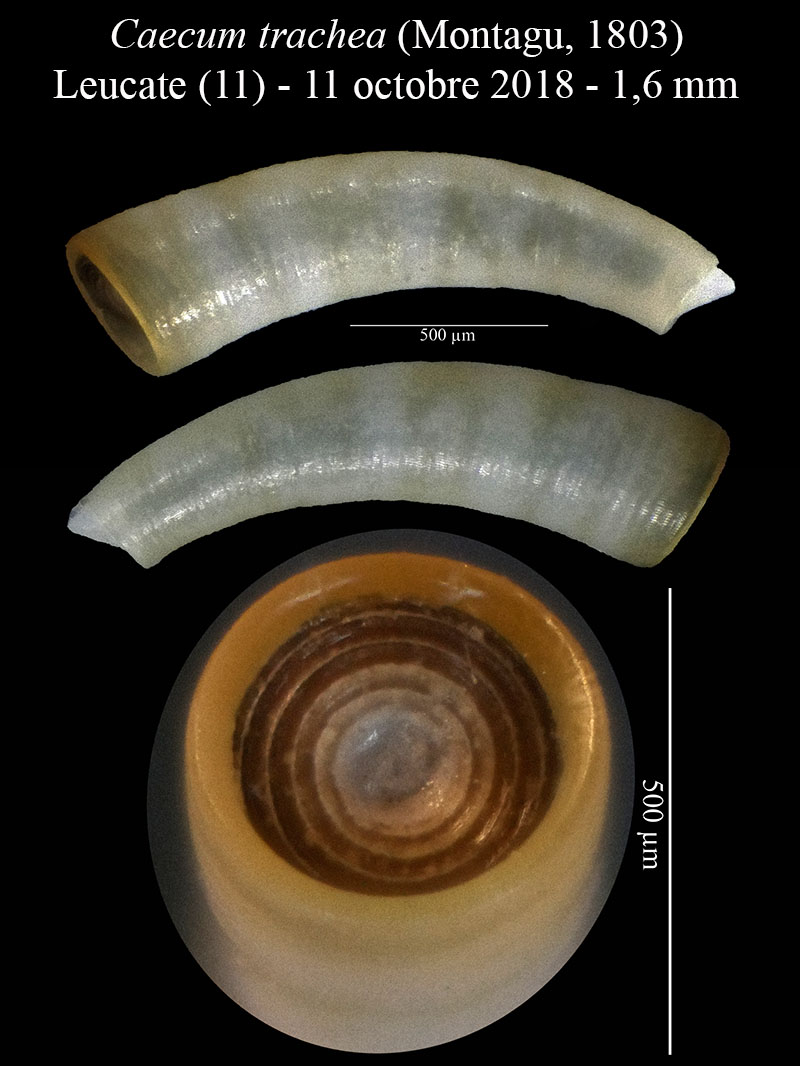 Caecum trachea #59233