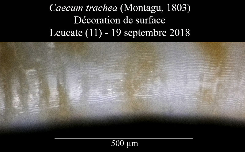 Caecum trachea #59237