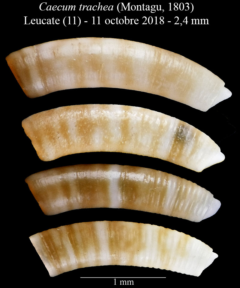 Caecum trachea #59235