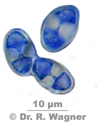 Caloplaca erythrocarpa #27373