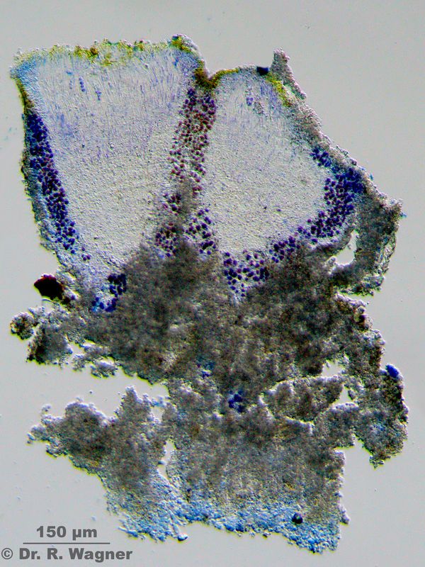Caloplaca erythrocarpa #27371