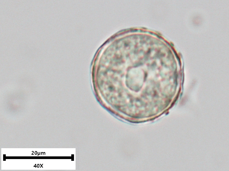 Caltha palustris L., 1753 - Pollen #70568