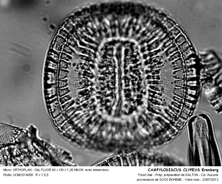 CAMPYLODISCUS CLYPEUS Erenberg #32847