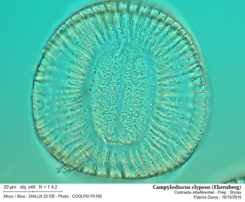 Campylodiscus clypeus (Ehrenberg) #18578