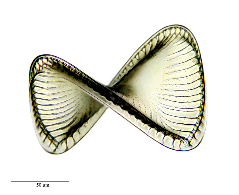 Campylodiscus noricus var. hibernica (Ehrenberg) Grunow #22943