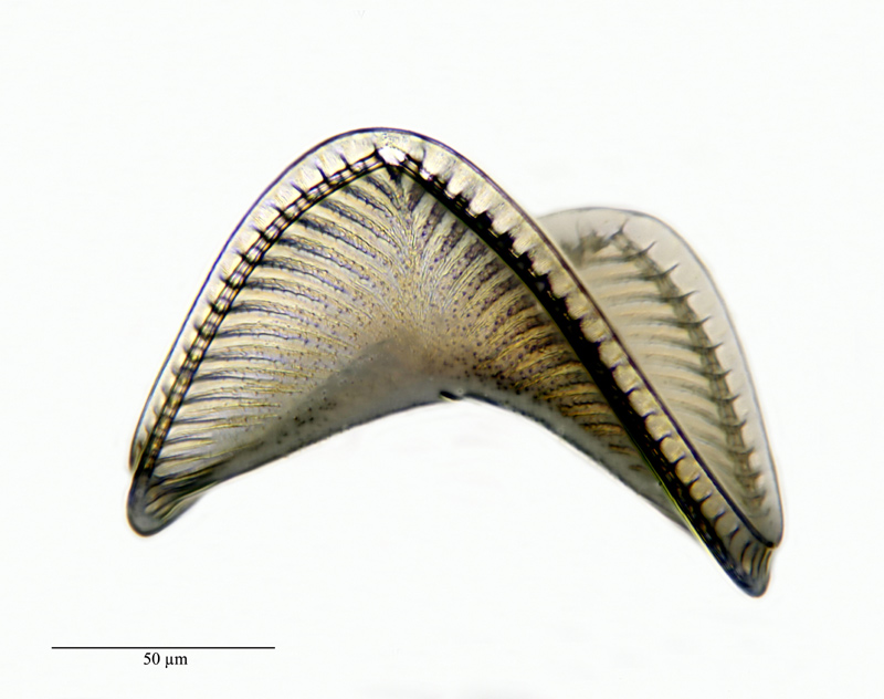 Campylodiscus noricus var. hibernica (Ehrenberg) Grunow #22942