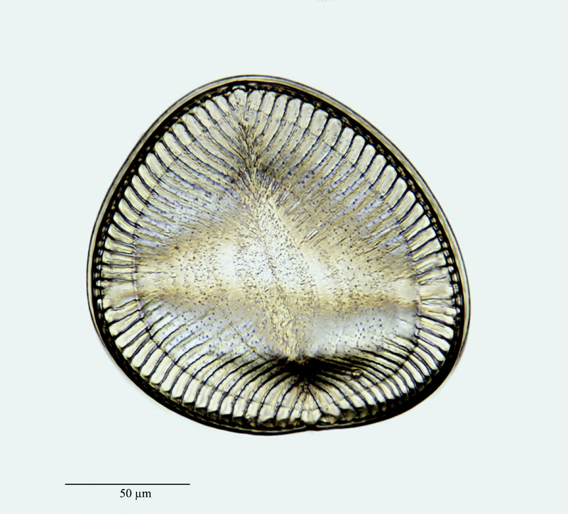 Campylodiscus noricus var. hibernica (Ehrenberg) Grunow #22941