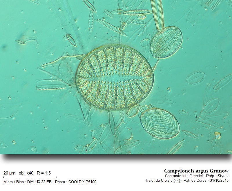 Campyloneis argus Grunow #18841
