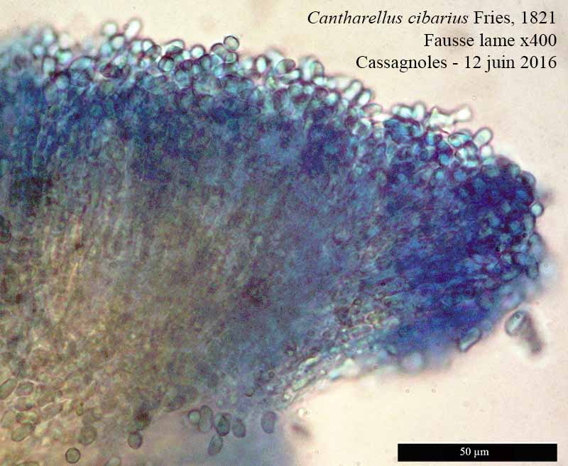 Cantharellus cibarius E.M. Fries : coupe, baside et spore #45710