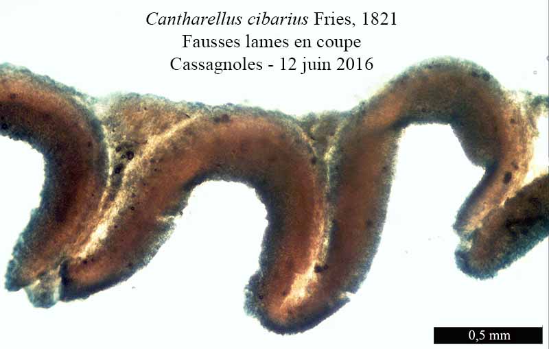 Cantharellus cibarius E.M. Fries : coupe, baside et spore #45708