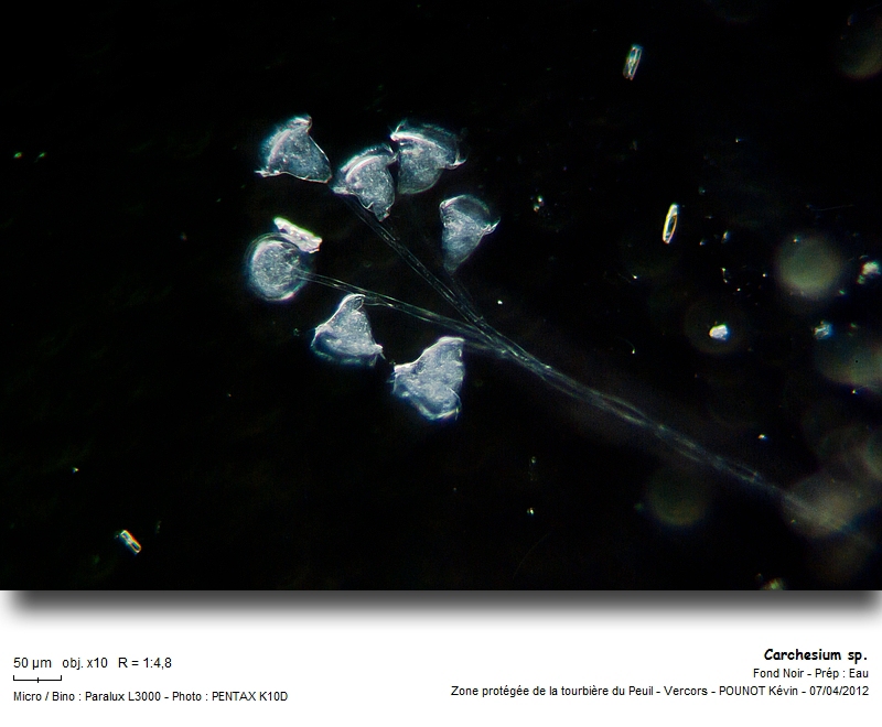 Carchesium sp. #26391